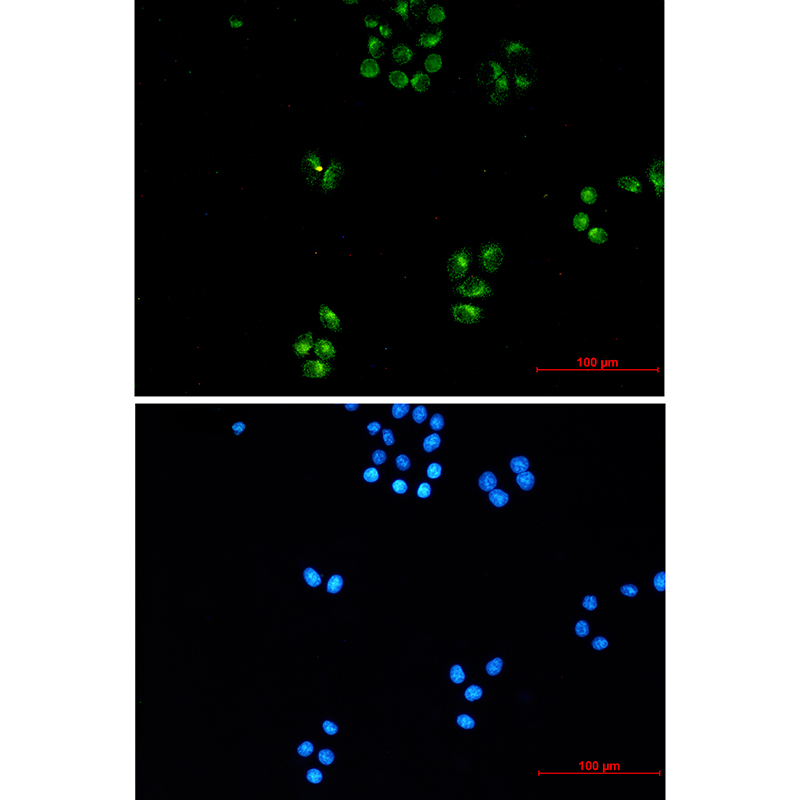 TFG Rabbit mAb